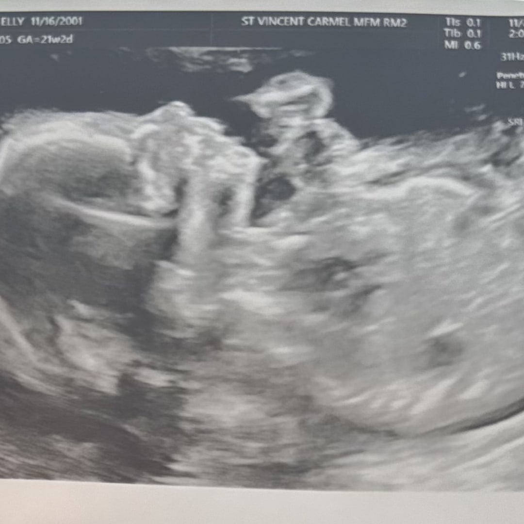 Photo shared by Elly for their Babylist baby registry.