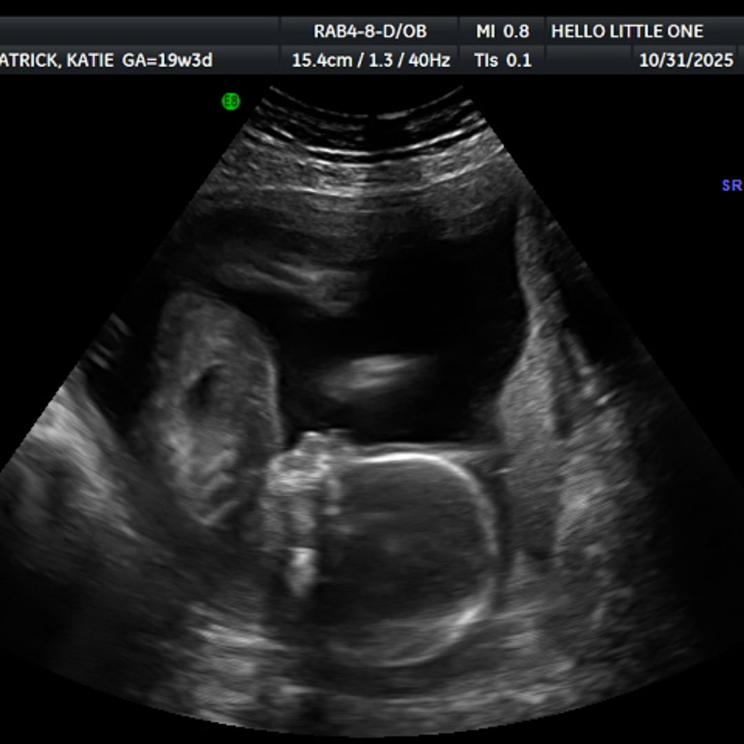 Photo shared by Katie for their Babylist baby registry.