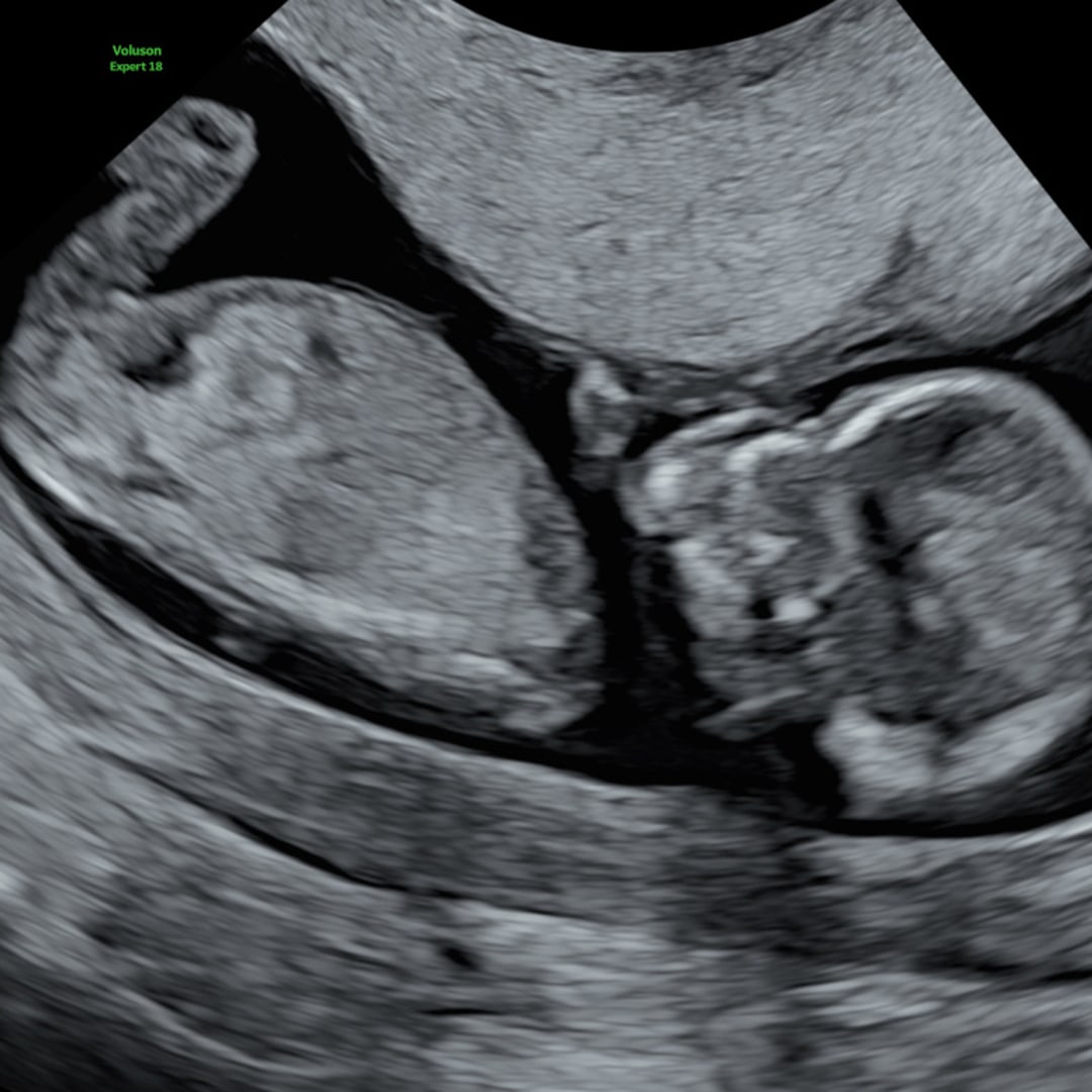 Photo shared by Mary Ann for their Babylist baby registry.