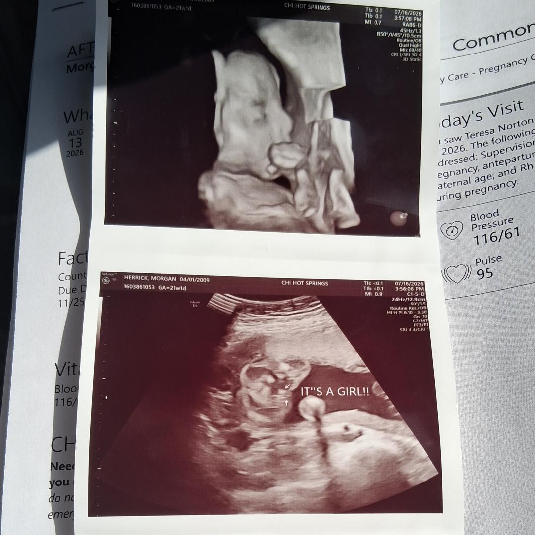 Photo shared by Morgan for their Babylist baby registry.