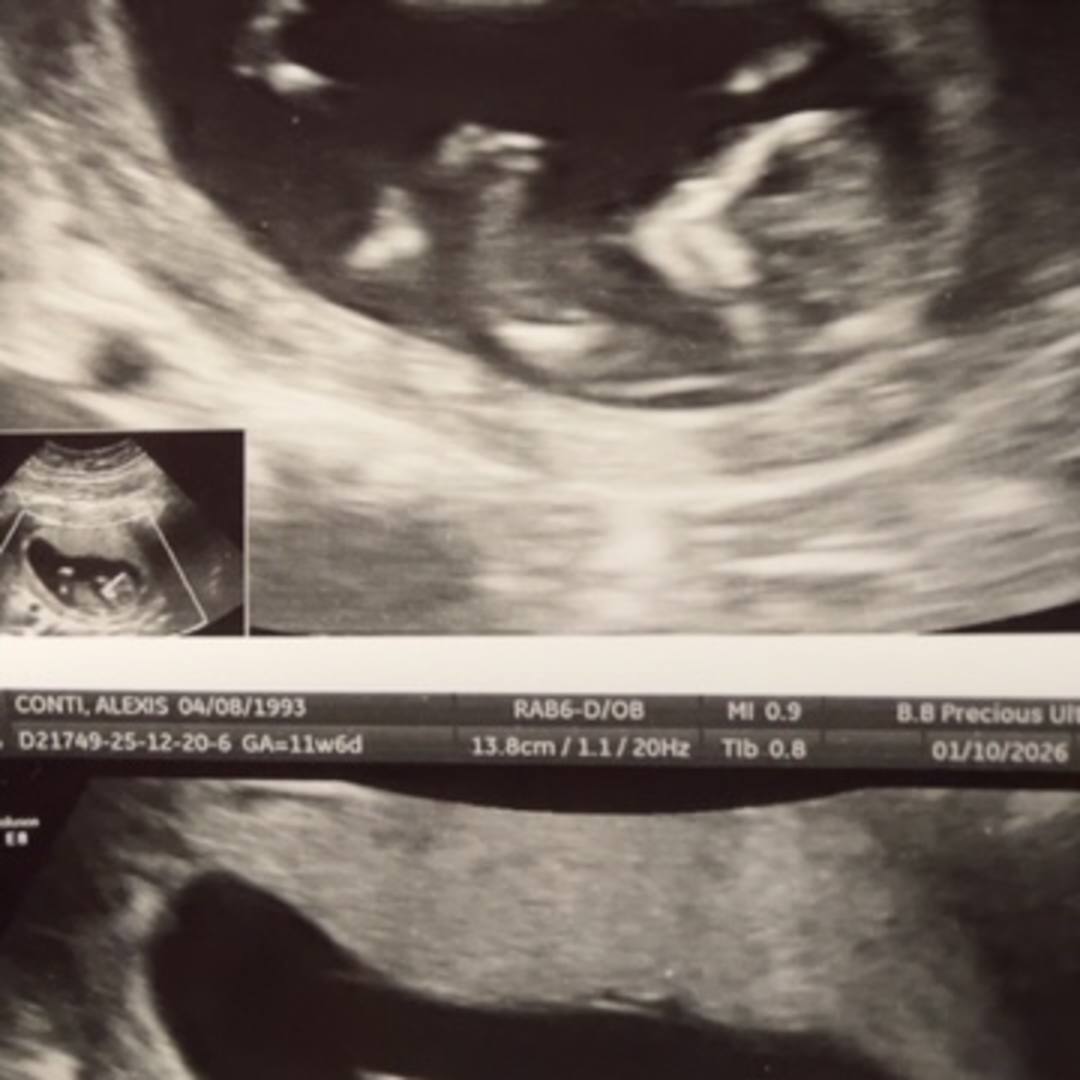 Photo shared by Alexis for their Babylist baby registry.