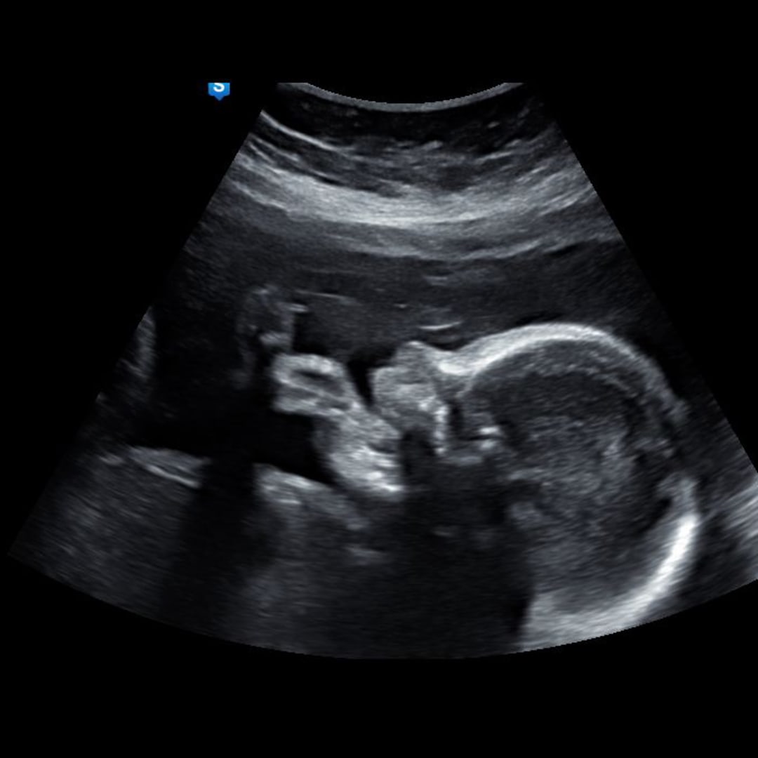 Photo shared by Katherine for their Babylist baby registry.