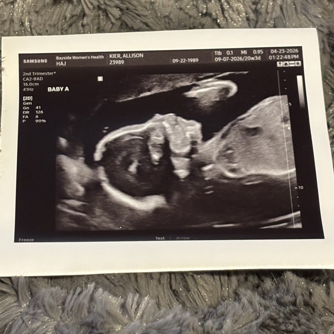 Photo shared by Allison for their Babylist baby registry.