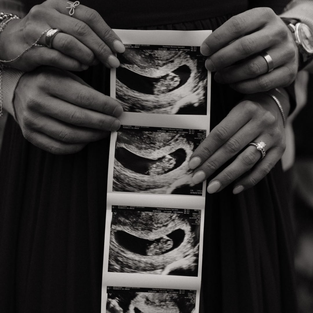 Photo shared by Ashley for their Babylist baby registry.