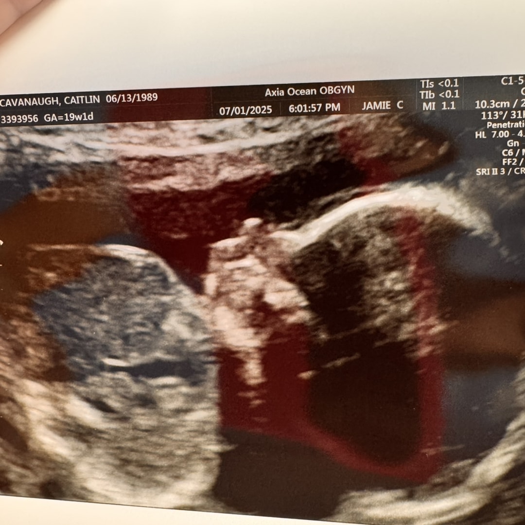 Photo shared by Caitlin for their Babylist baby registry.