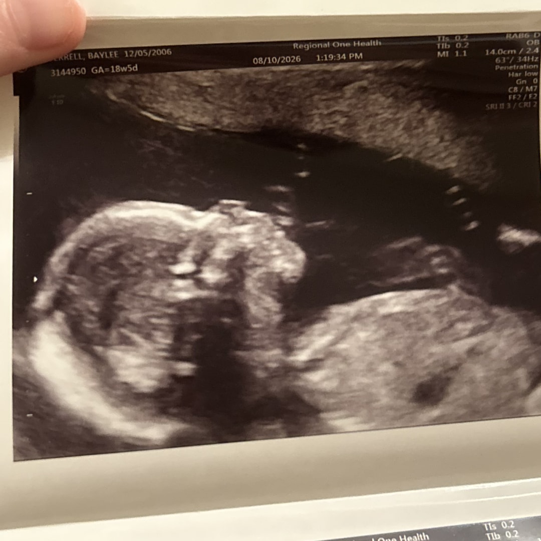 Photo shared by Baylee for their Babylist baby registry.