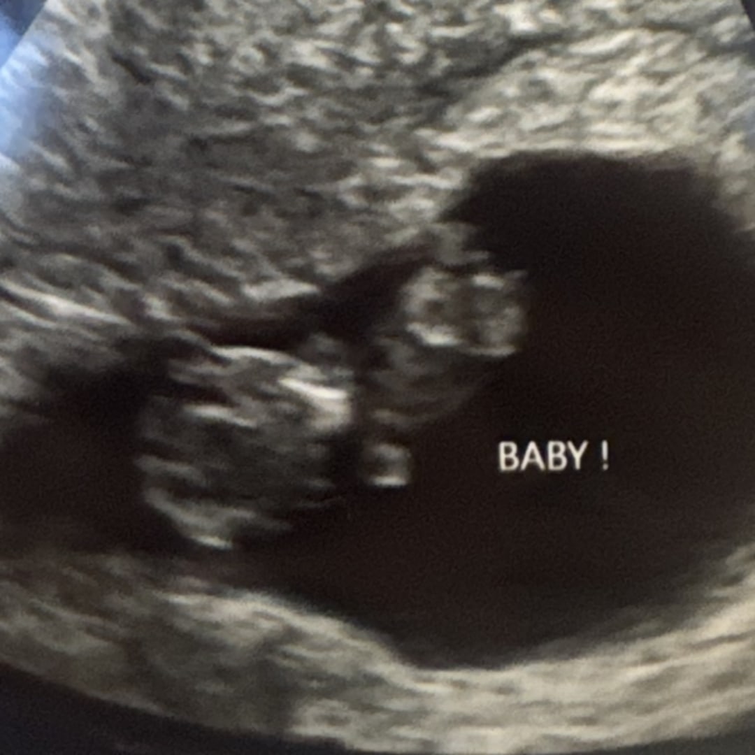 Photo shared by Shelby for their Babylist baby registry.