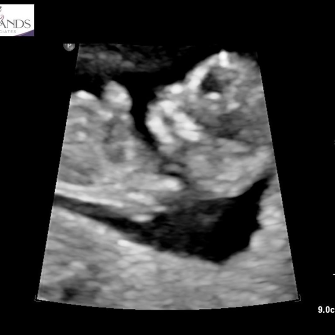 Photo shared by Karla Vanessa for their Babylist baby registry.