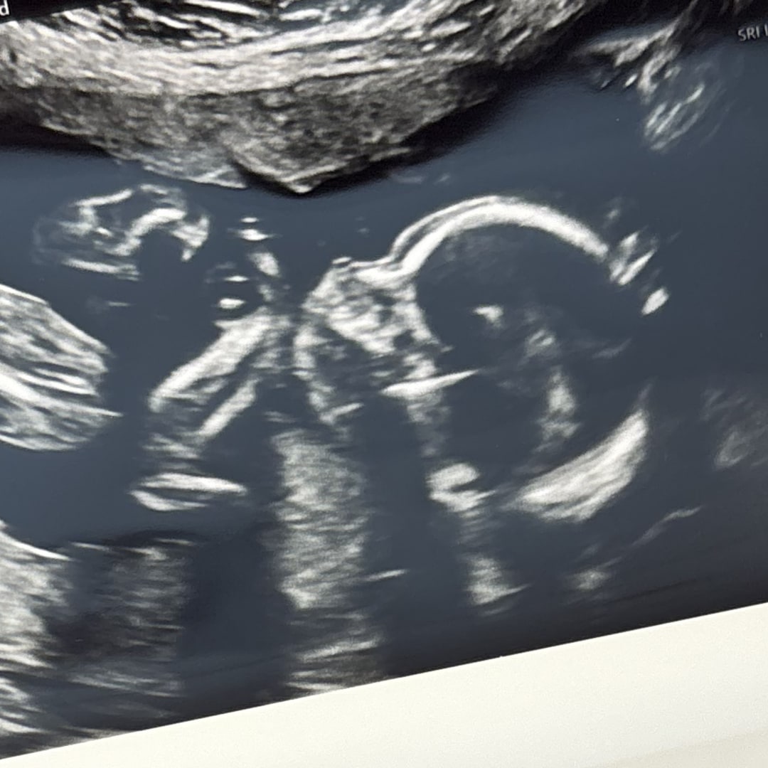 Photo shared by Braylin for their Babylist baby registry.