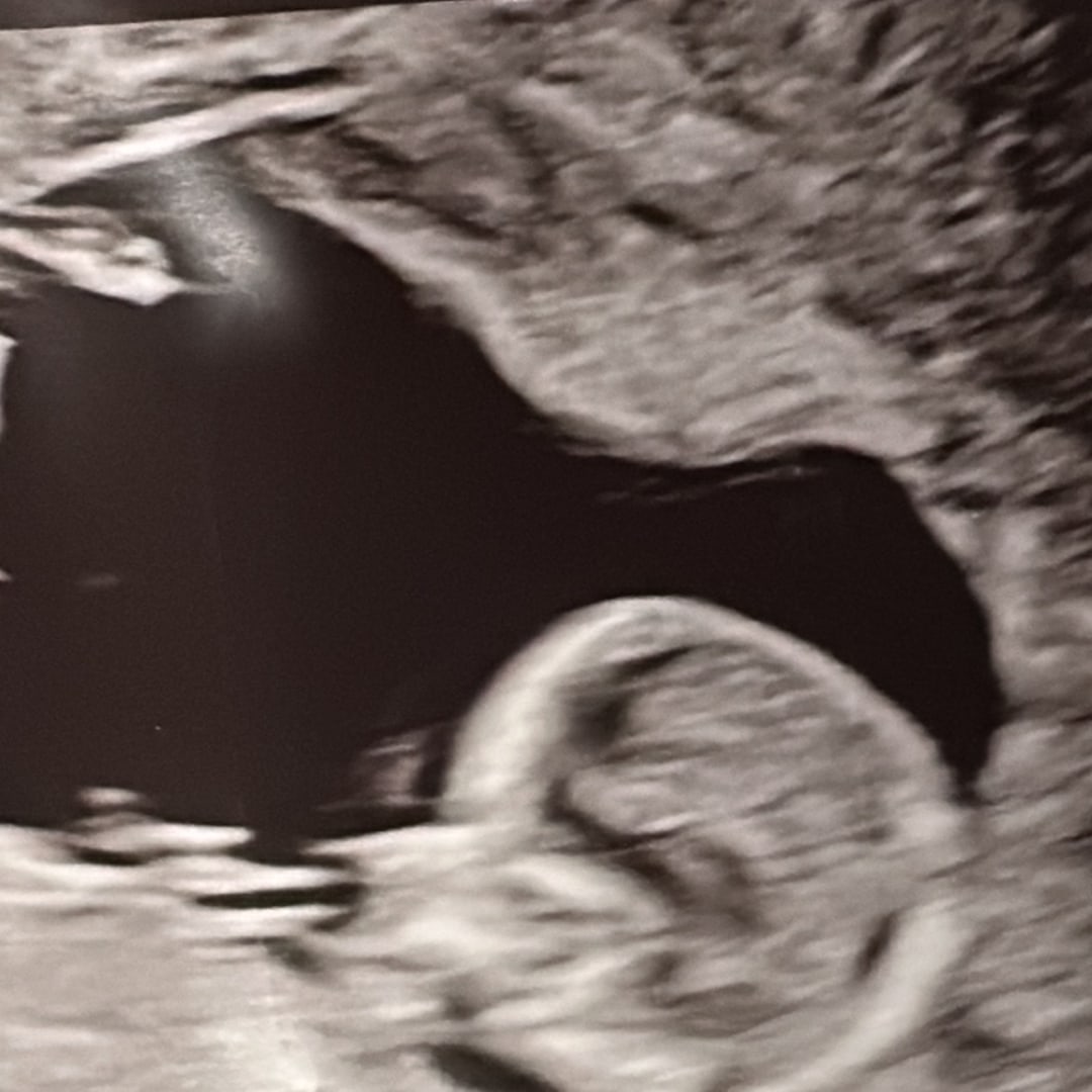 Photo shared by Celeste for their Babylist baby registry.