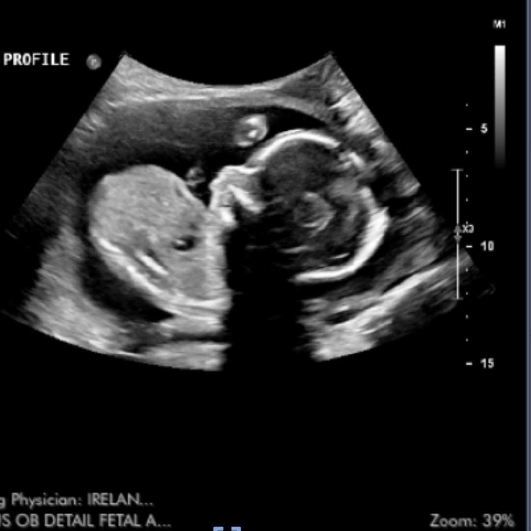 Photo shared by Jessica for their Babylist baby registry.