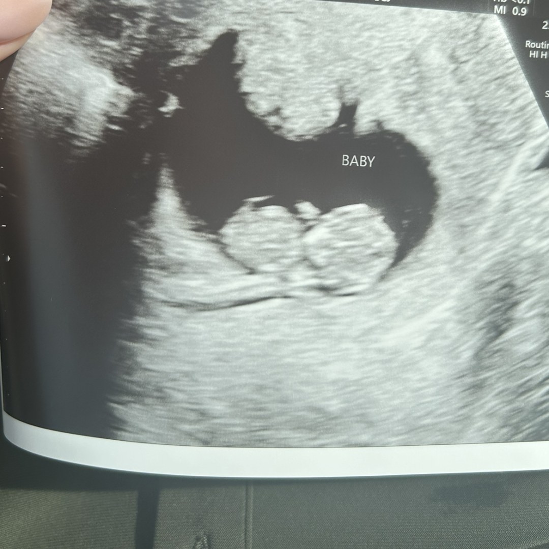 Photo shared by Morgan for their Babylist baby registry.
