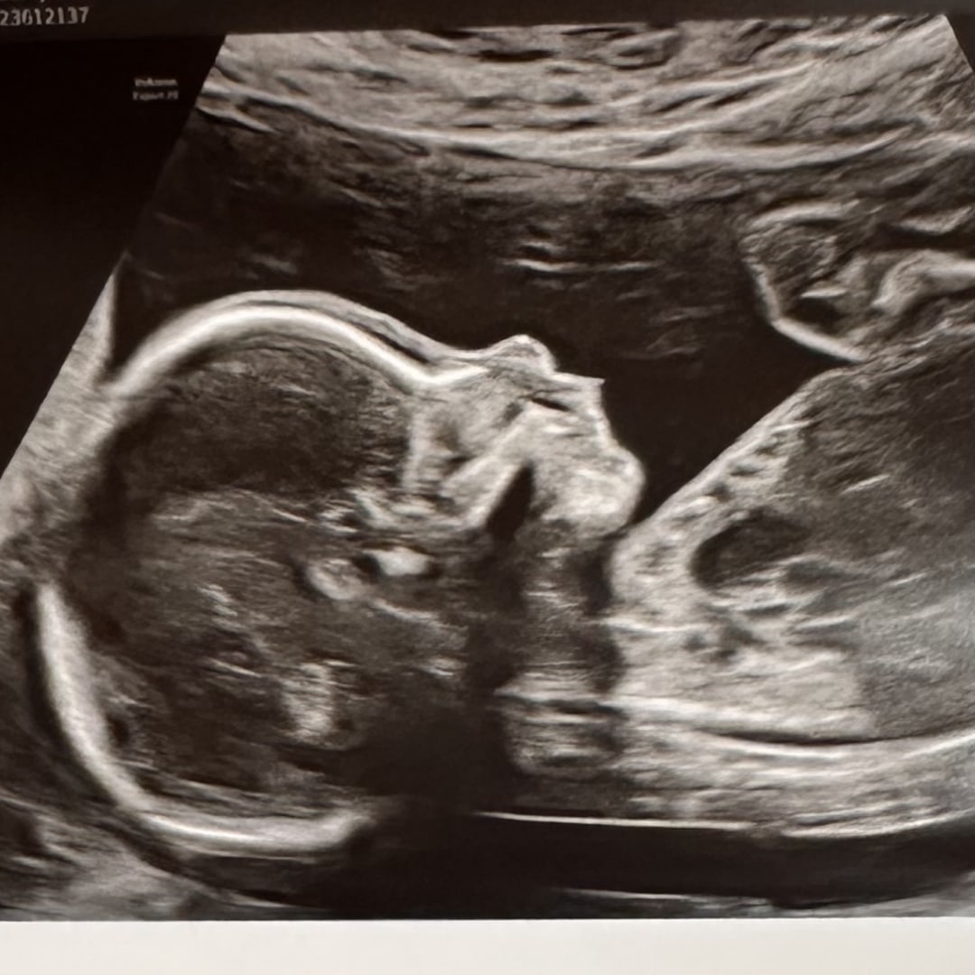 Photo shared by Julia for their Babylist baby registry.