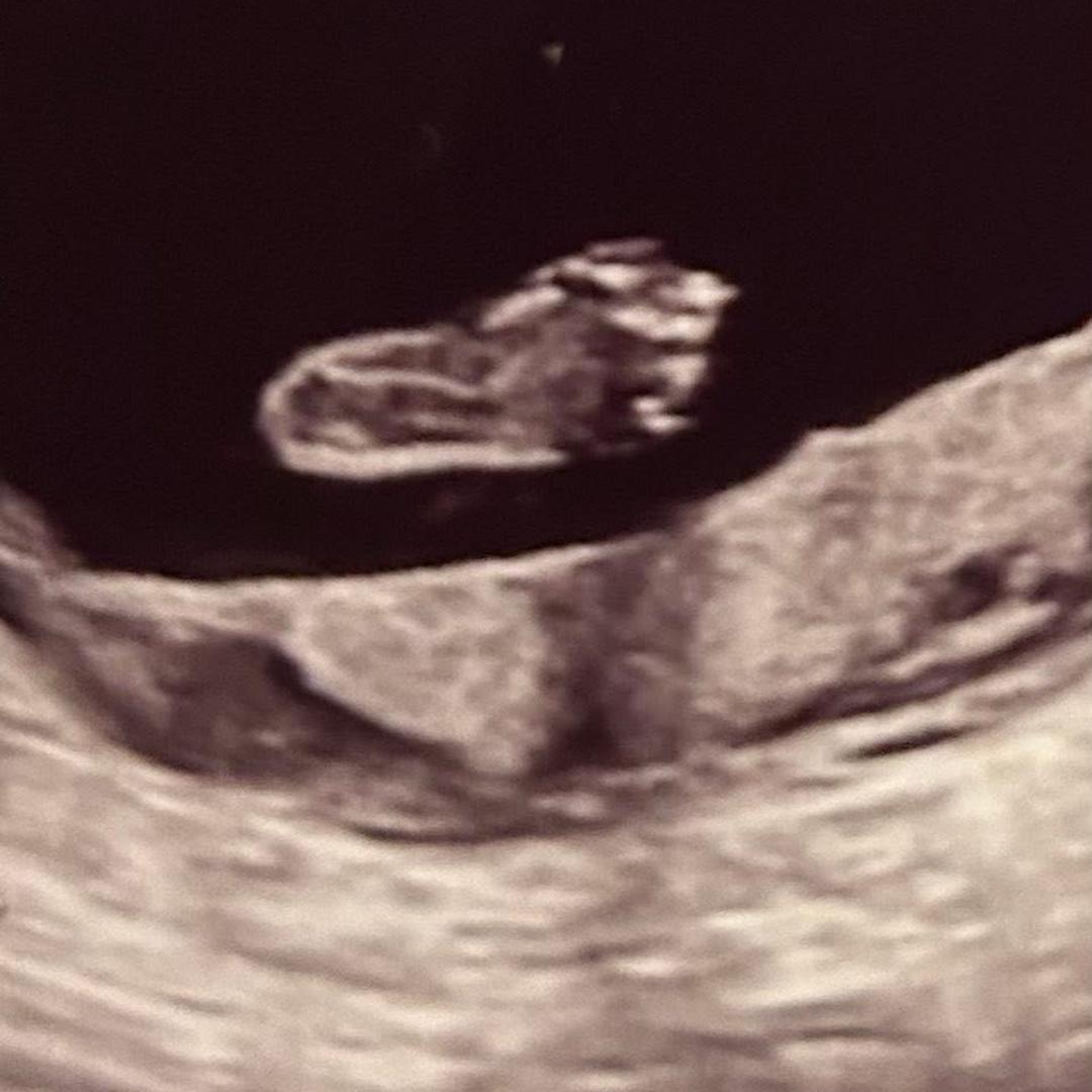 Photo shared by Celeste for their Babylist baby registry.