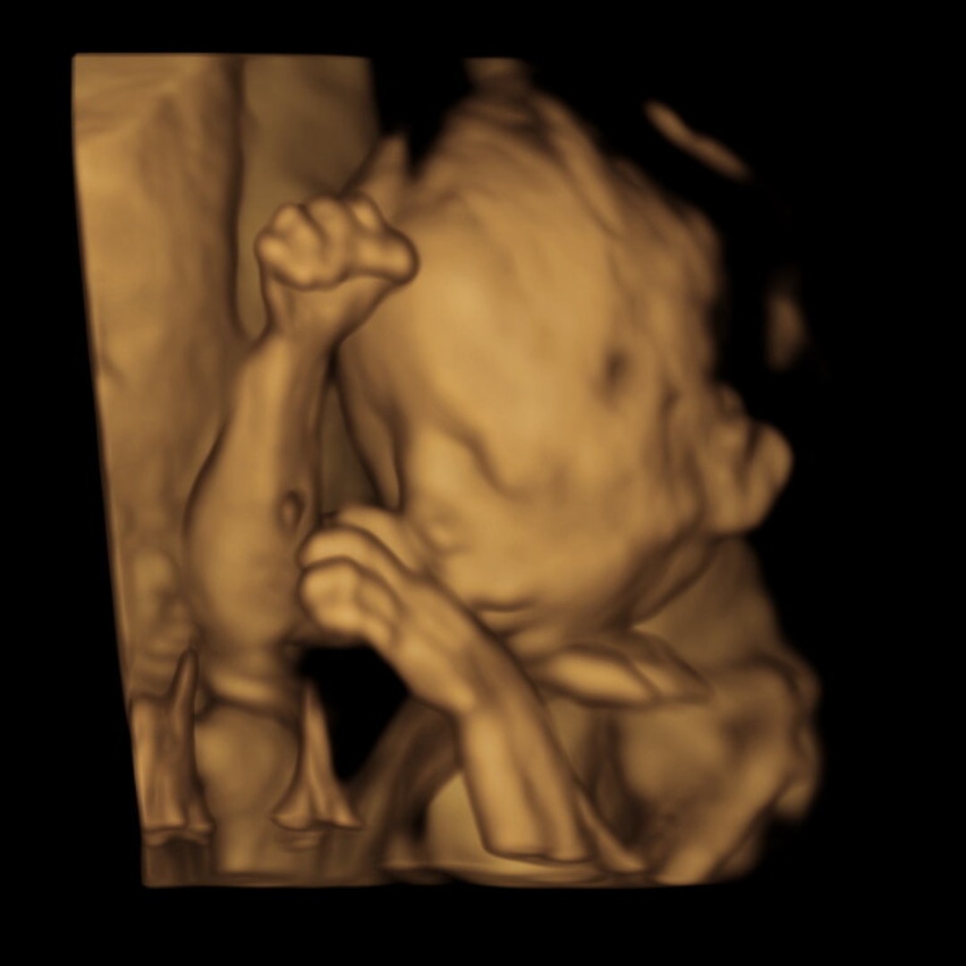 Photo shared by Malaney for their Babylist baby registry.