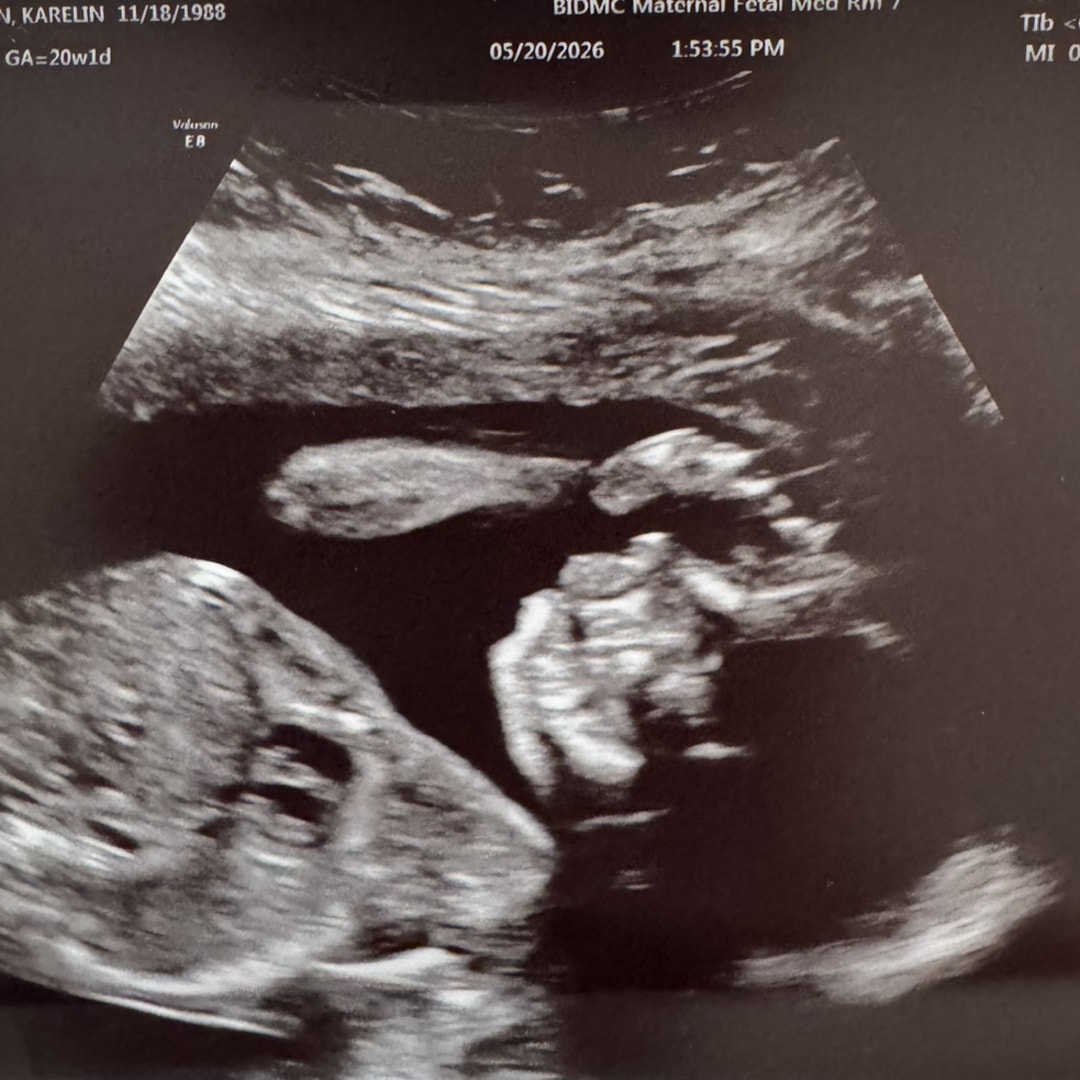 Photo shared by Karelin for their Babylist baby registry.