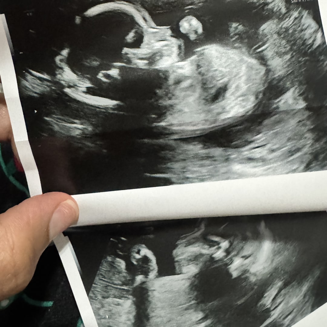 Photo shared by Yetzi for their Babylist baby registry.