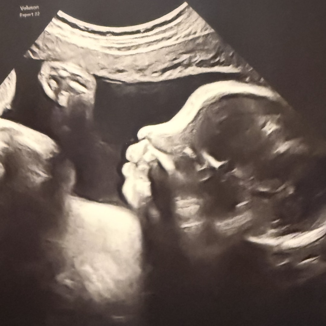 Photo shared by Aliyah for their Babylist baby registry.