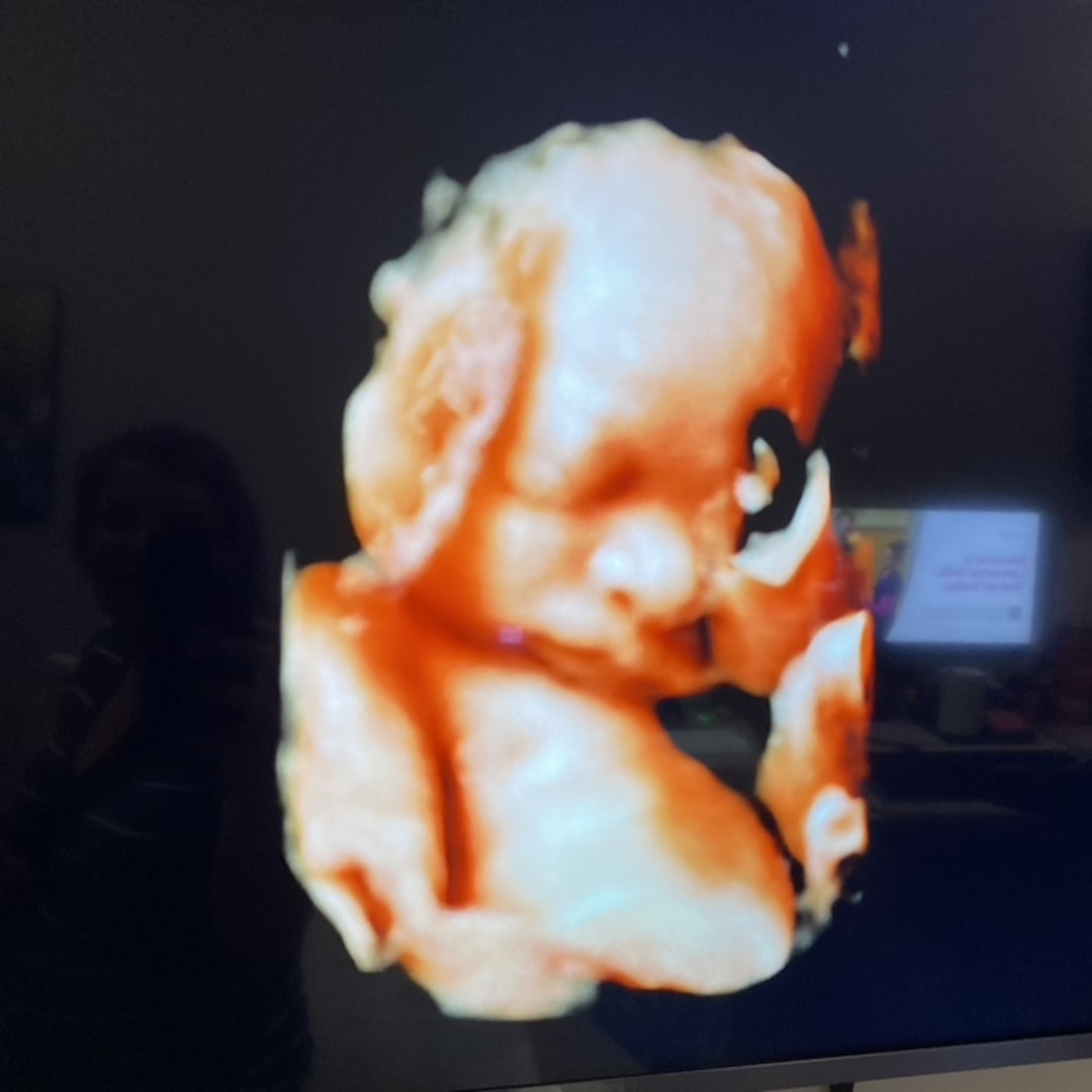 Photo shared by Carolyn ‘Cj’ for their Babylist baby registry.