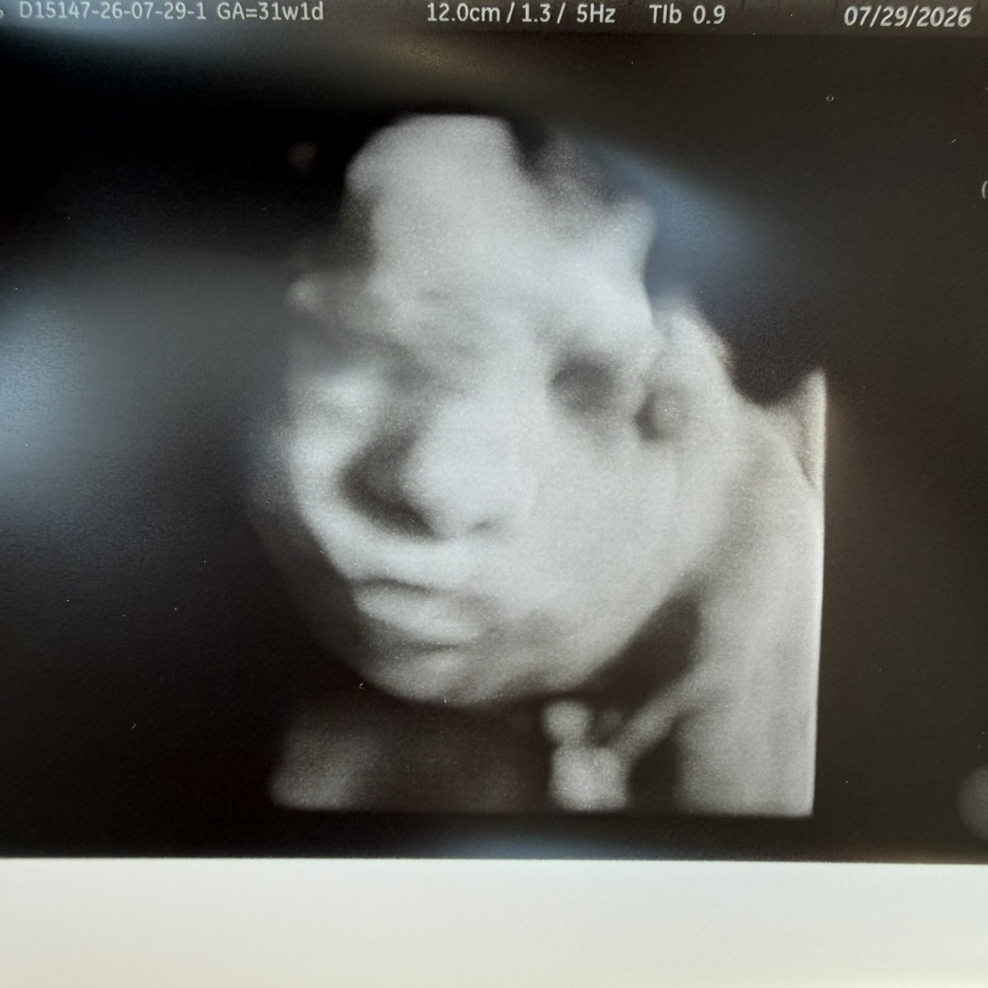 Photo shared by Meghan for their Babylist baby registry.