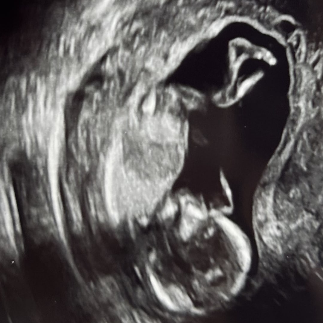 Photo shared by Ashby Grace for their Babylist baby registry.