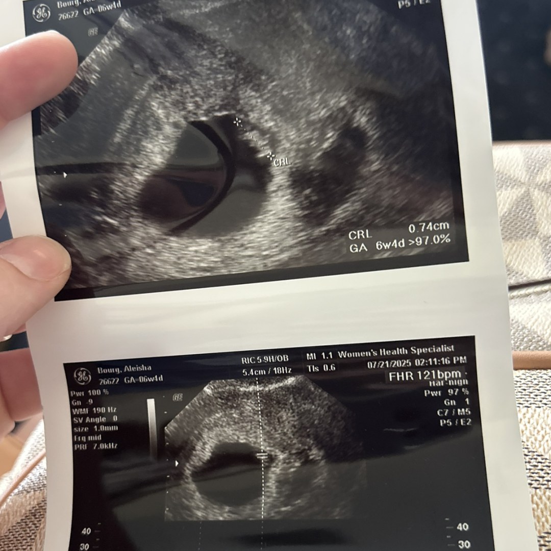 Photo shared by Aleisha for their Babylist baby registry.