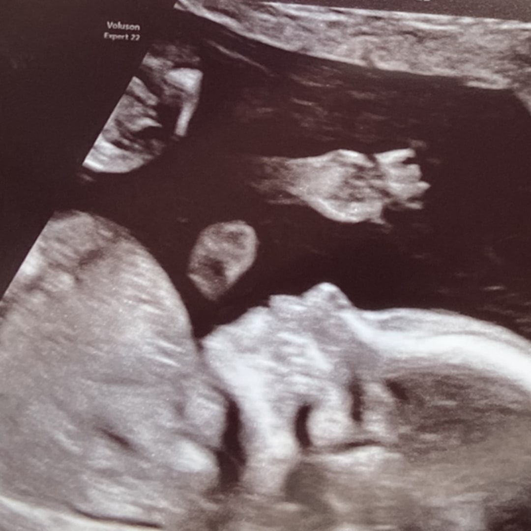 Photo shared by Victoria for their Babylist baby registry.