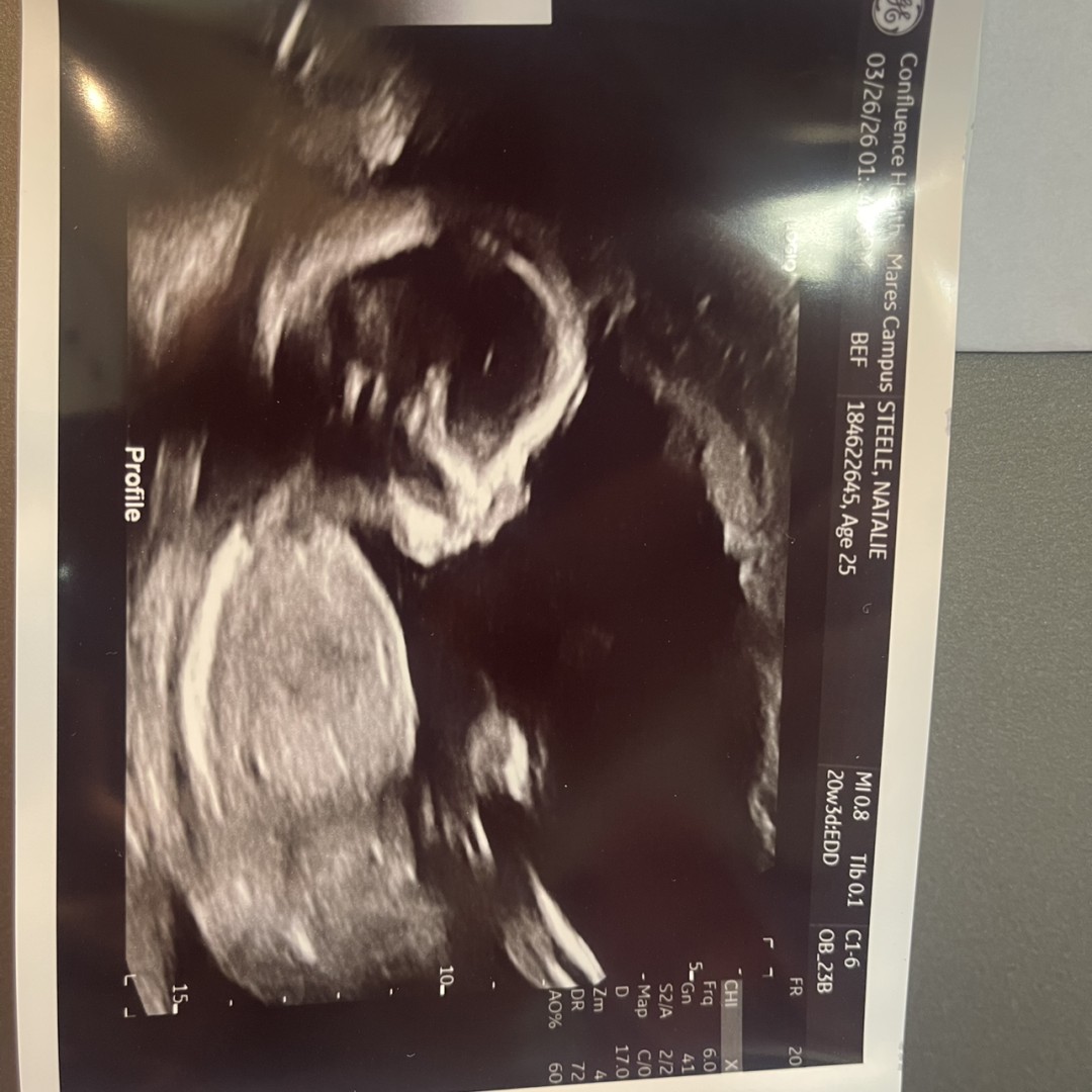 Photo shared by Natalie for their Babylist baby registry.