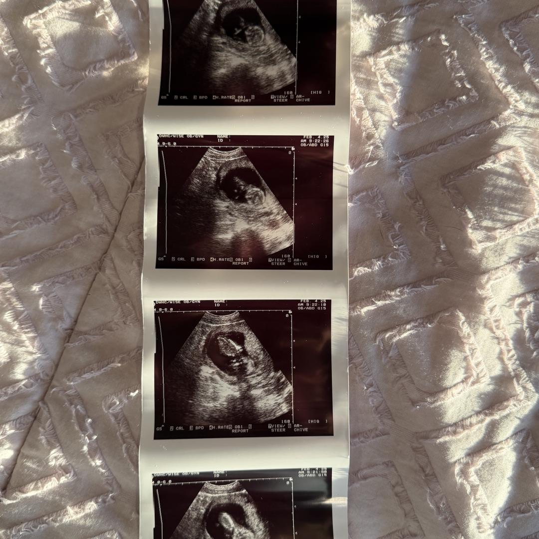 Photo shared by Kacie for their Babylist baby registry.