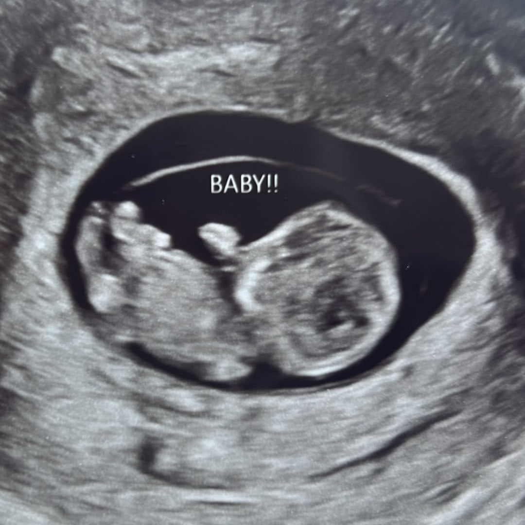 Photo shared by Shannon for their Babylist baby registry.