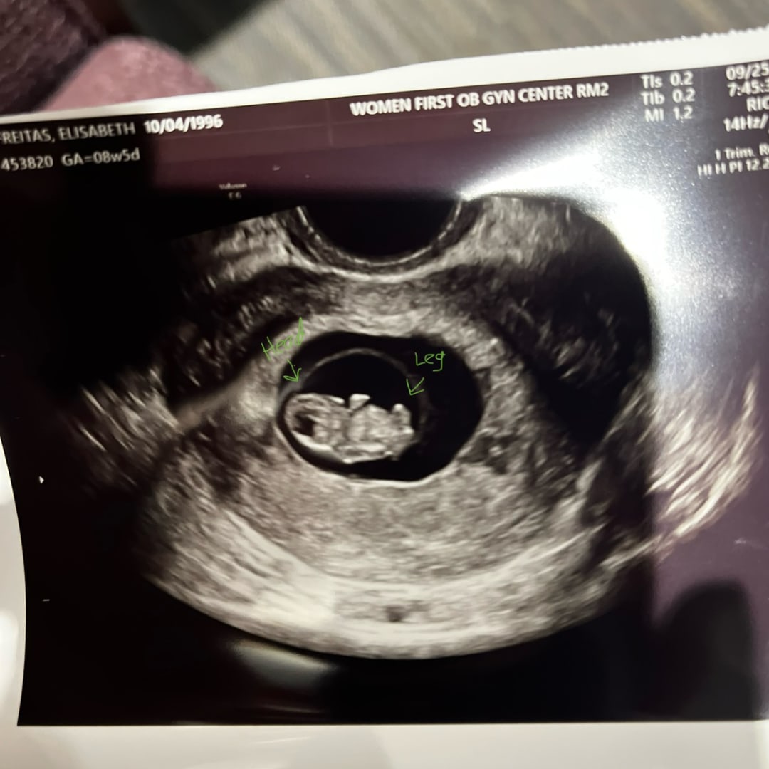 Photo shared by Elisabeth for their Babylist baby registry.