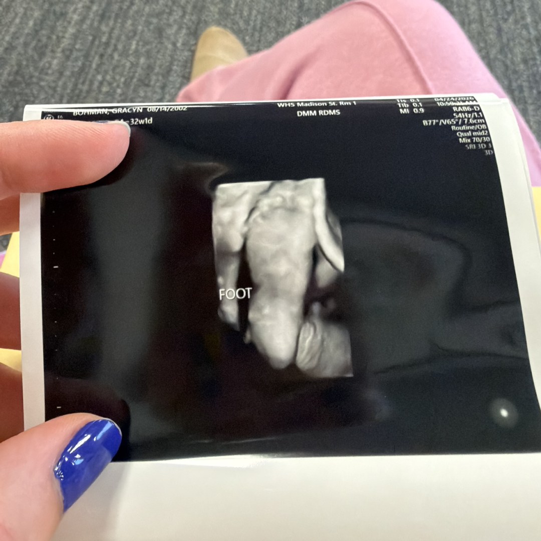 Photo shared by Grace for their Babylist baby registry.