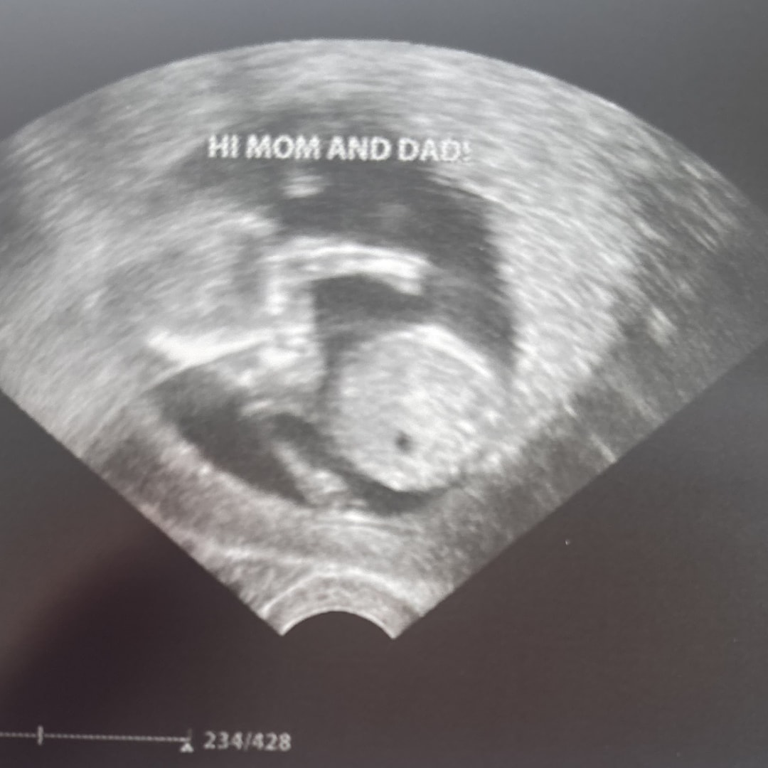 Photo shared by Ayana for their Babylist baby registry.