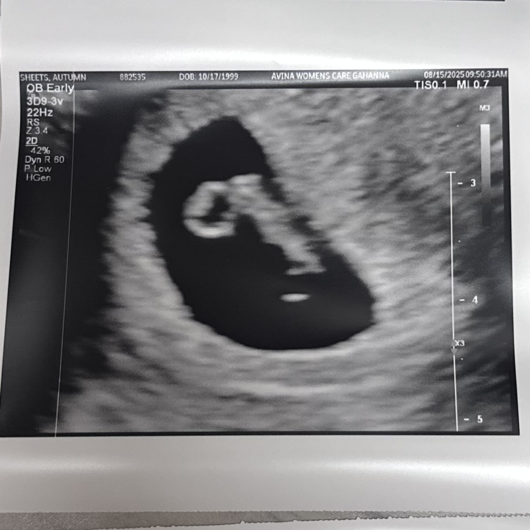 Photo shared by Autumn for their Babylist baby registry.