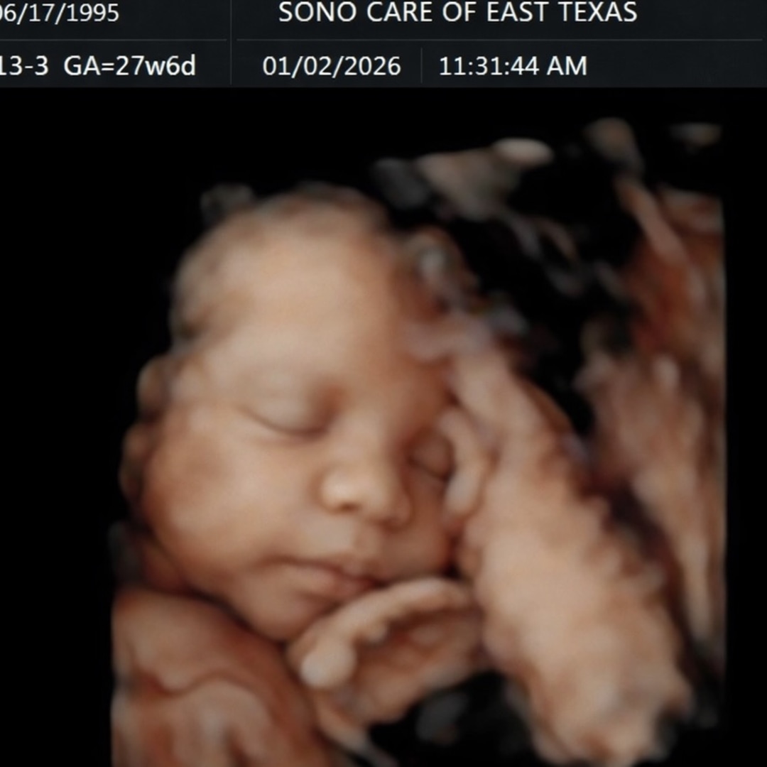 Photo shared by Morgan for their Babylist baby registry.