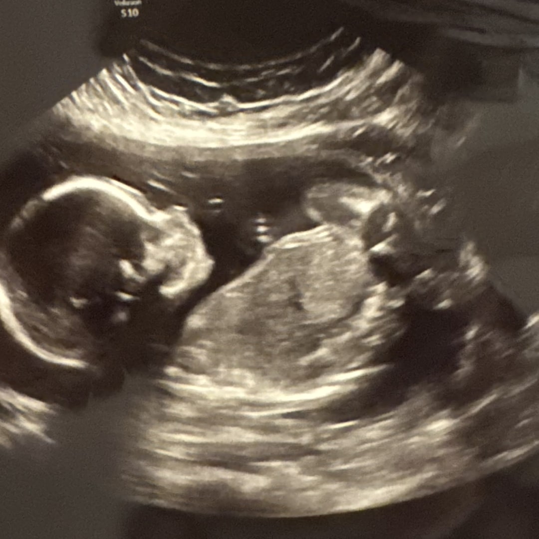 Photo shared by Taylor for their Babylist baby registry.