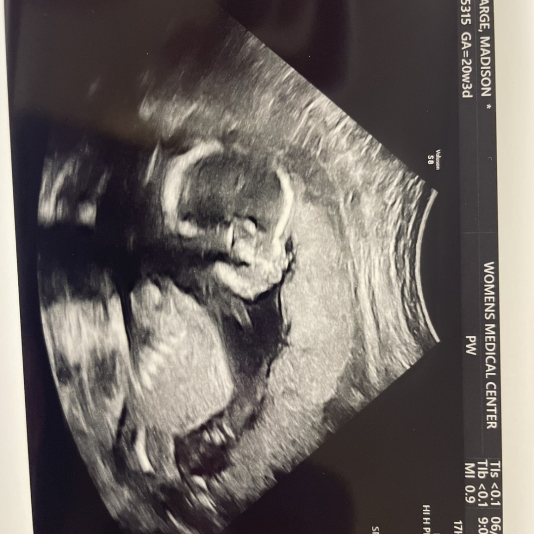 Photo shared by Madison for their Babylist baby registry.