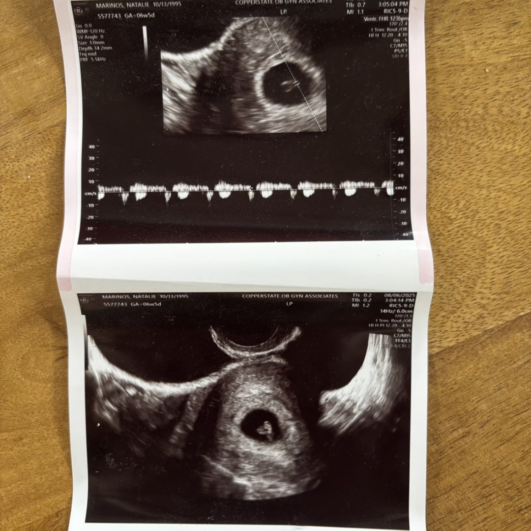 Photo shared by Natalie for their Babylist baby registry.