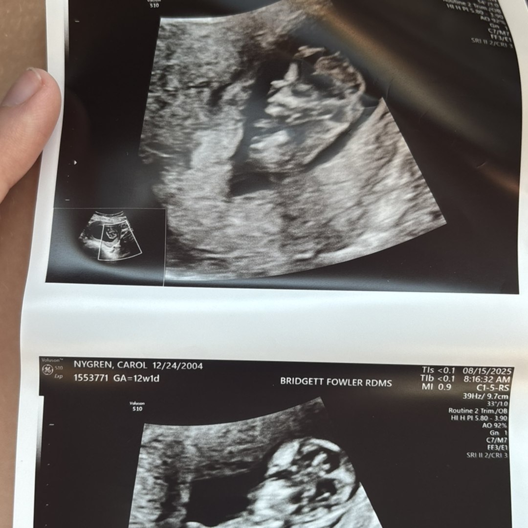 Photo shared by Carol for their Babylist baby registry.