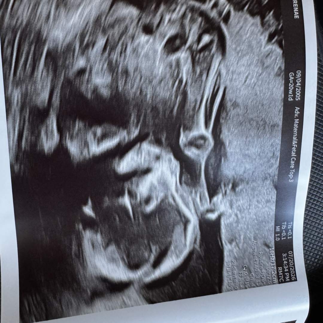 Photo shared by Emily for their Babylist baby registry.