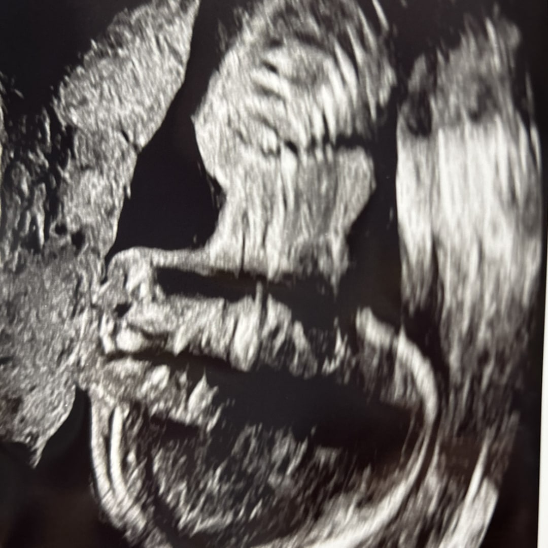 Photo shared by Ashby for their Babylist baby registry.