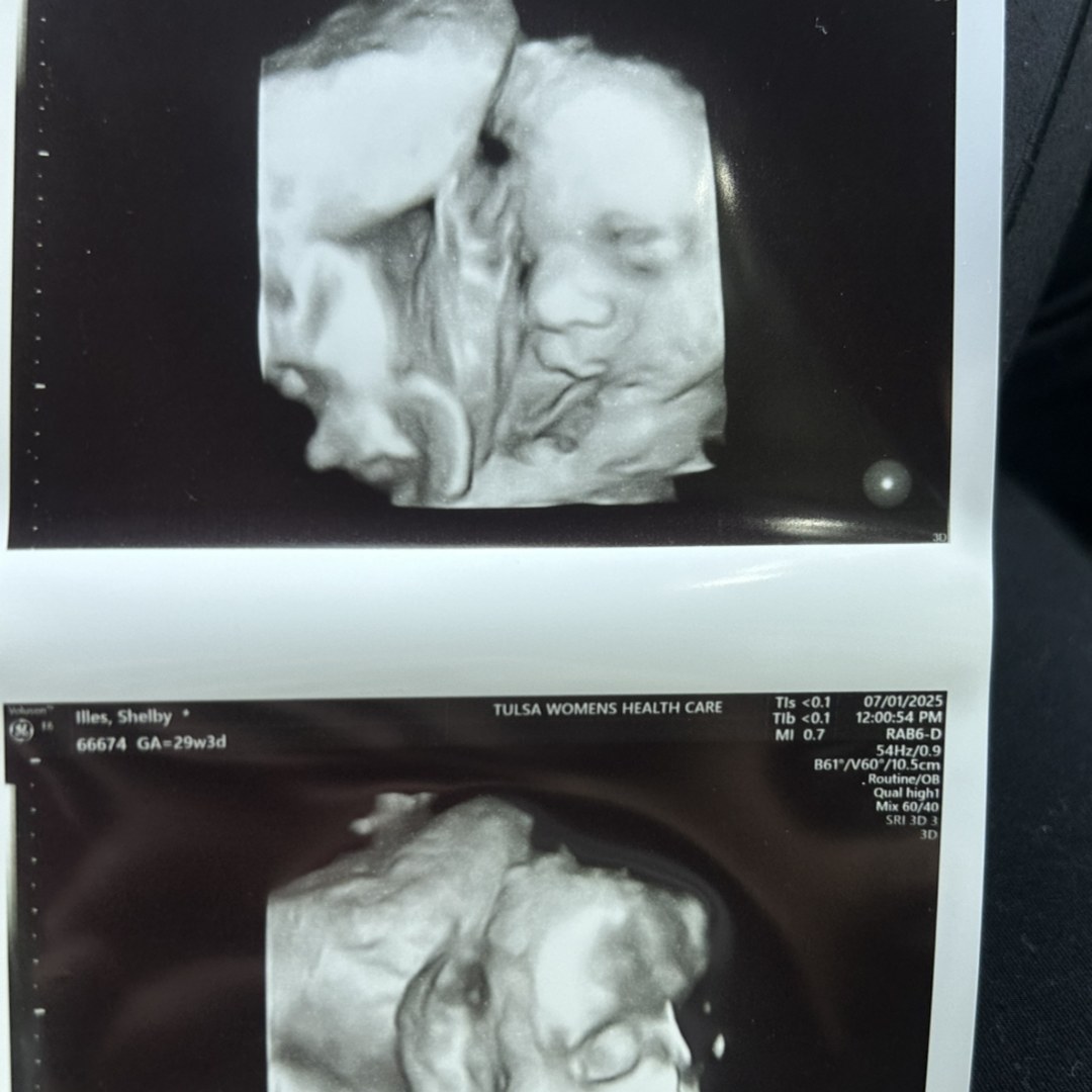 Photo shared by Shelby for their Babylist baby registry.