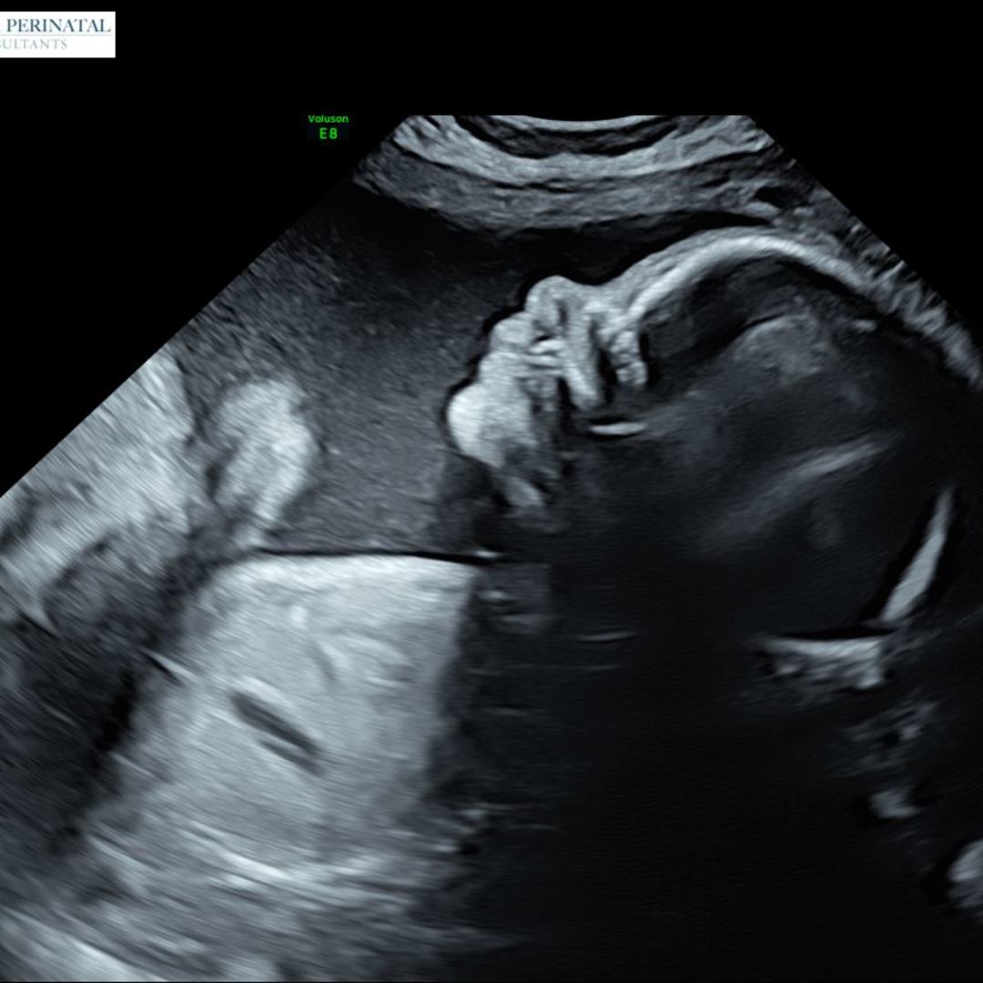 Photo shared by Michelle for their Babylist baby registry.