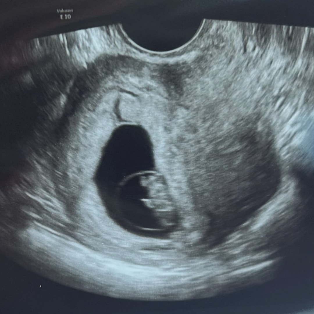 Photo shared by Briana for their Babylist baby registry.