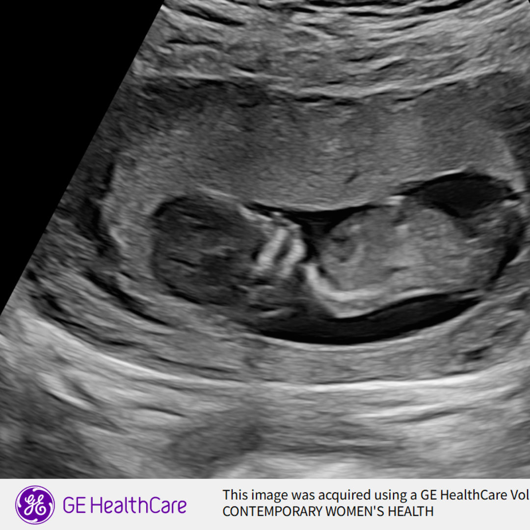 Photo shared by Haley for their Babylist baby registry.