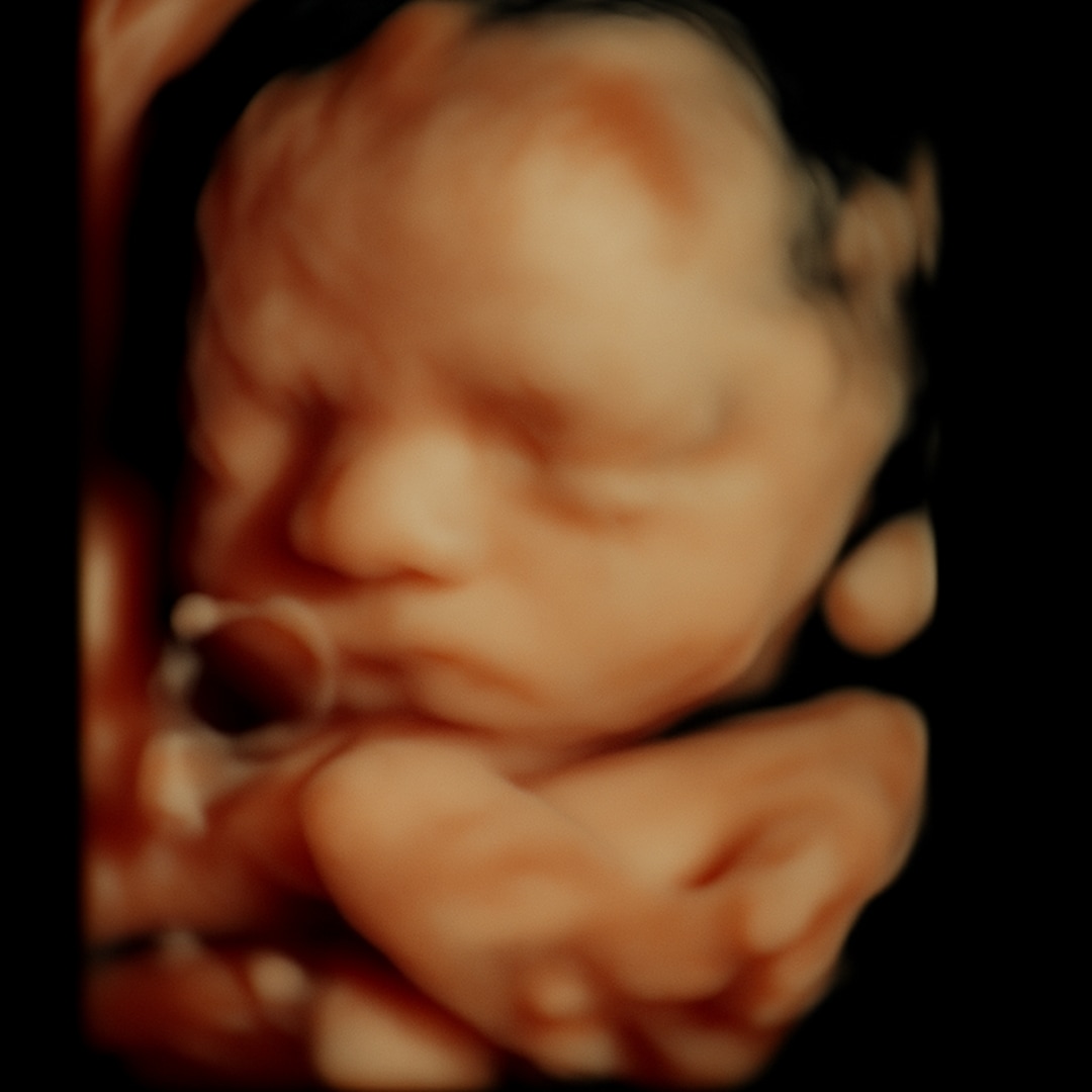 Photo shared by Khia for their Babylist baby registry.