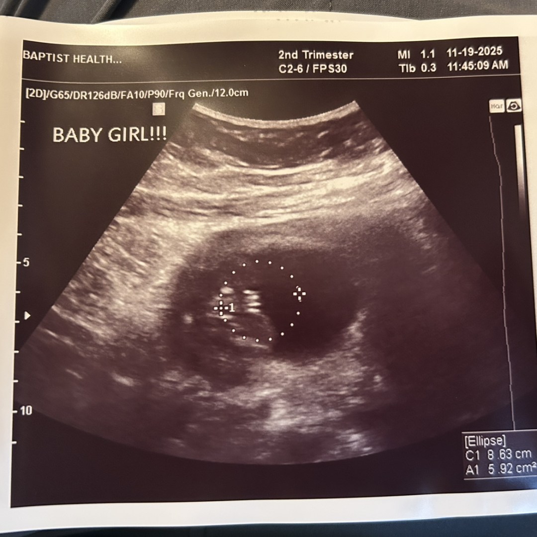 Photo shared by Sharra for their Babylist baby registry.