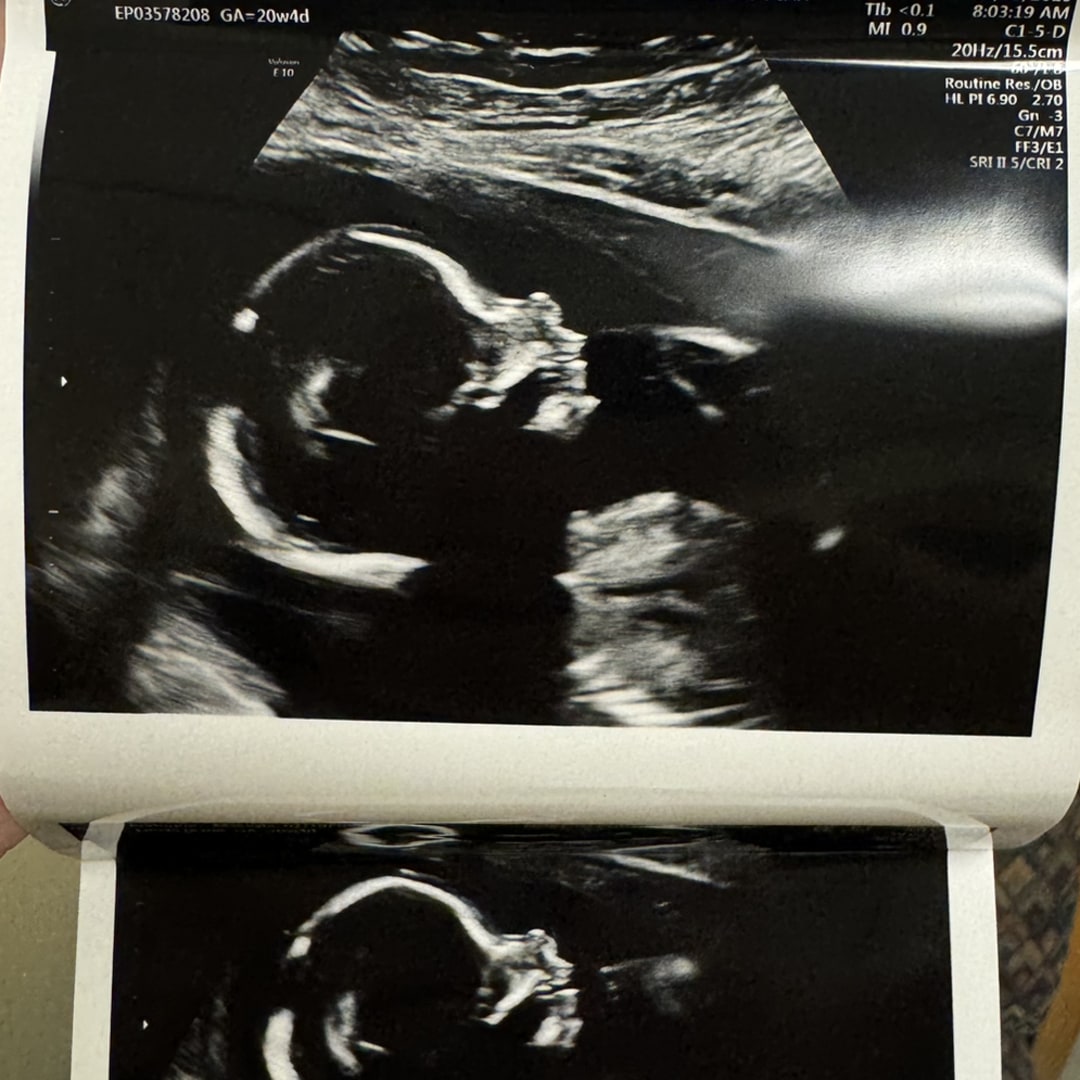 Photo shared by Makayla for their Babylist baby registry.
