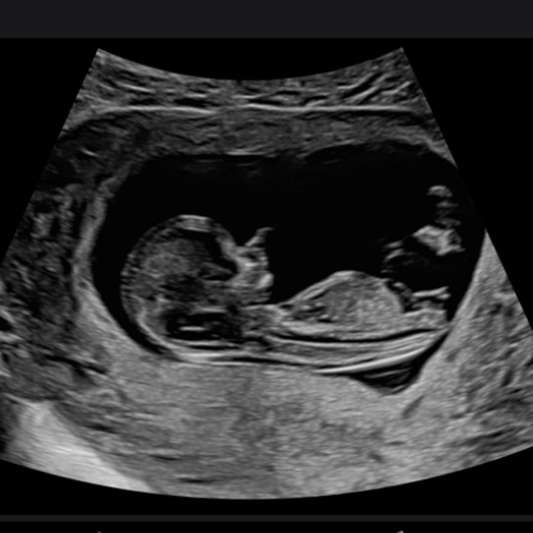 Photo shared by Romero for their Babylist baby registry.