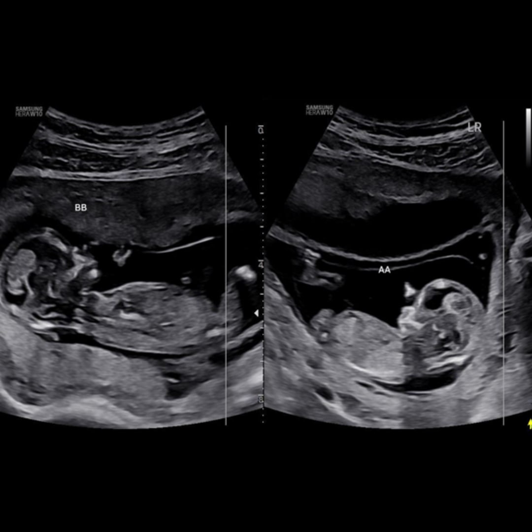 Photo shared by Jessica for their Babylist baby registry.